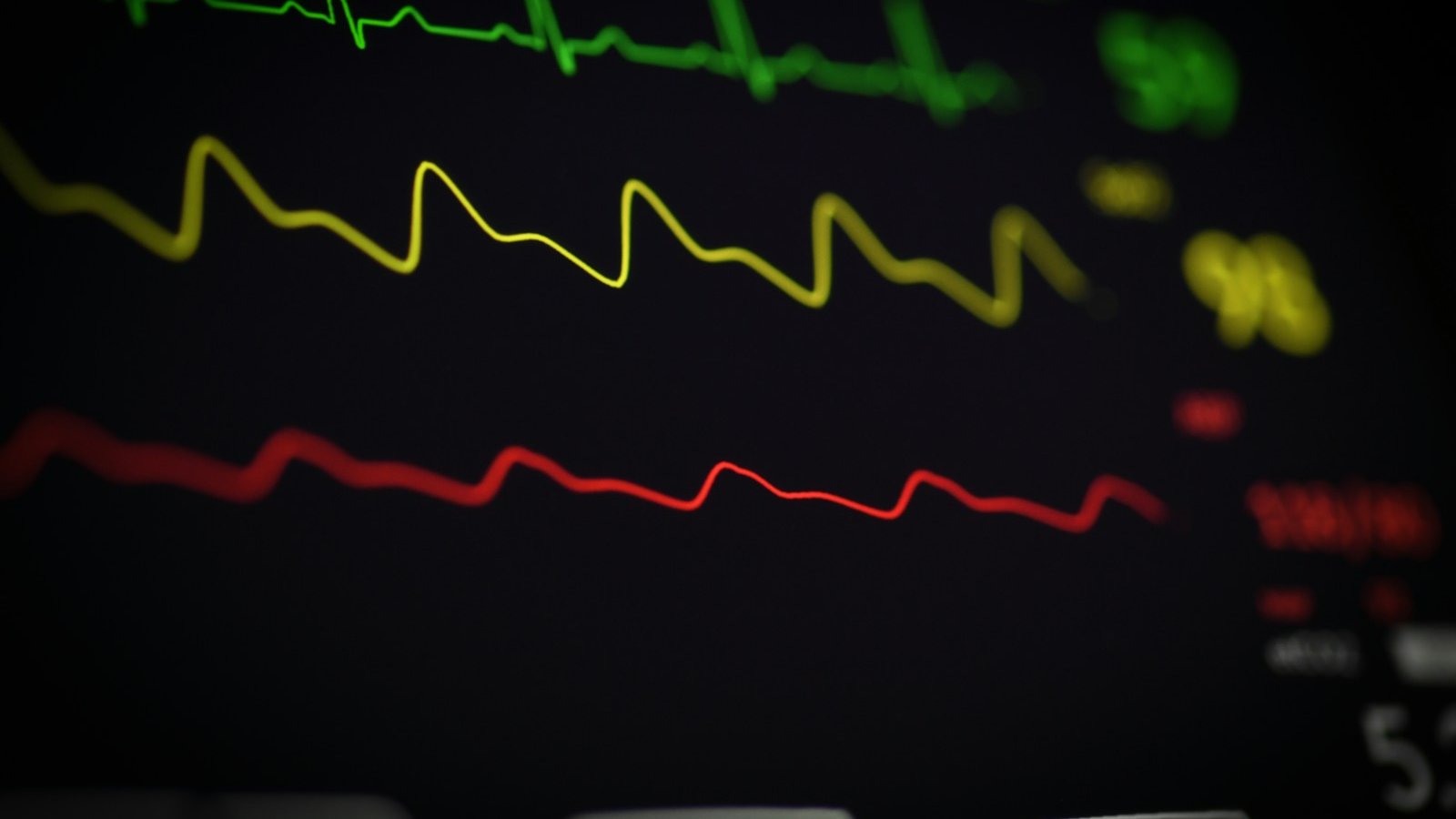 a close up of a computer screen with a line of ecg